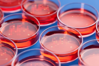 Antibiotic Selection, Expression vectors and FBS